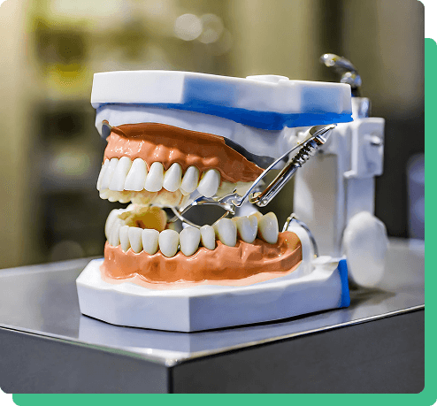 How Are Dentures Made?